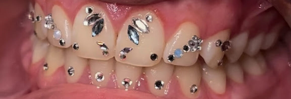 Solecita Gems: Tooth Gems and Teeth Whitening